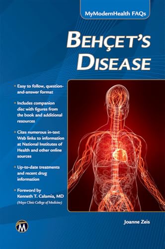 Behcet’s Disease (MyModernHealth FAQs)