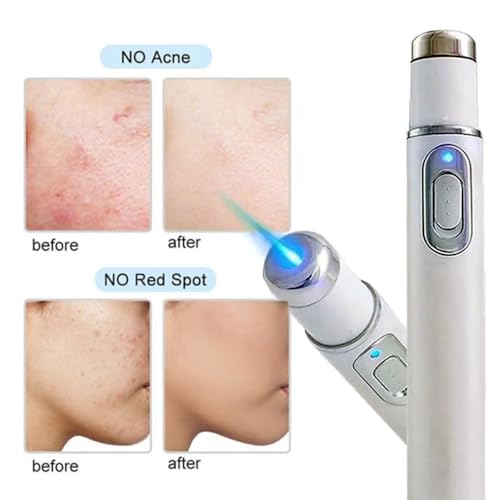 Acne Remover - Blue Light Laser Pen for Scar and Acne Removal Therapy – Portable Acne Laser Pen for Scar, Wrinkle, and Blemish Treatment Beauty Device - Image 3