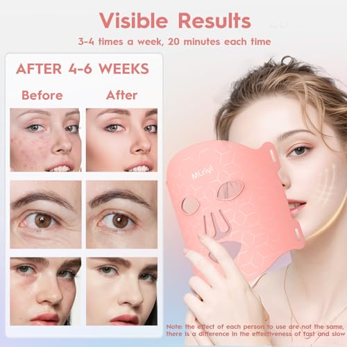 Mlriyl LED Face Mask, 7 Colour Red Light Therapy Mask, LED Photon Facial Skin Care Device for Anti Aging, Wrinkle Reduction, Acne Treatment, Rejuvenation & Hydration, Gifts for Women/Men - Image 2