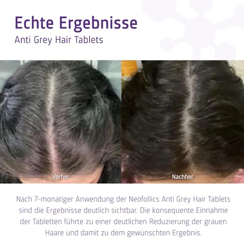 Neofollics Anti-Grau-Tabletten – 60 Stk. – Zweistufiges Supplement mit Katalase & Melanin Complex™ – Unterstützt die natürliche Haarpigmentierung – Vegane Formel – Für Männer & Frauen