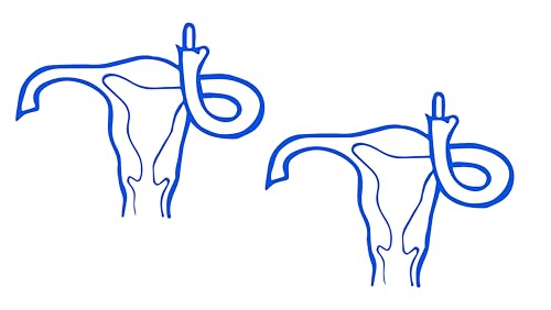 2 Pack - Women's Right to Choose - Abortion Rights - Roe vs. Wade - Right to Life |Vinyl Decal| 5.5 Inches Wide by 4.3 HOM2247A.067 Blue