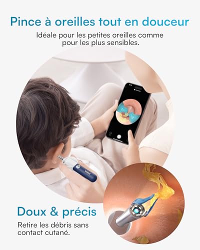 BEBIRD Nettoyeur d'Oreille avec Caméra HD 1920P - Sonde Flexible et Pince Incluse, pour un Nettoyage Précis et Confortable à Domicile – vue 4