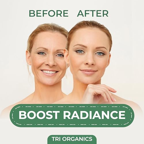Image of Niacinamide Powder (Vitamin B3) | Cosmetic Grade, Water Soluble | For DIY Skincare, Serums & Creams | Helps Reduce Dark Spots, Oil & Pores