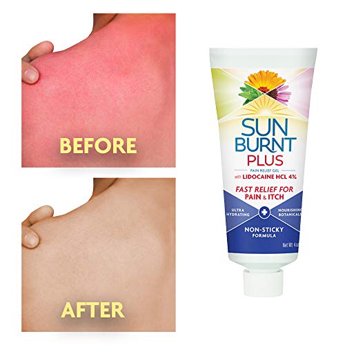 Sunburnt Plus After-Sun Gel With Lidocaine thumb #2