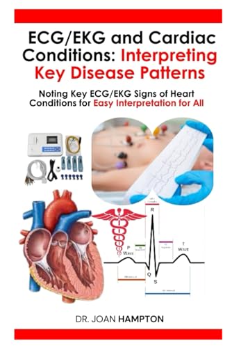Ecg/Ekg And Cardiac Conditions: Interpreting Key Disease Patterns: Noting Key Ecg/Ekg Signs Of Heart Conditions For Easy Interpretation For All