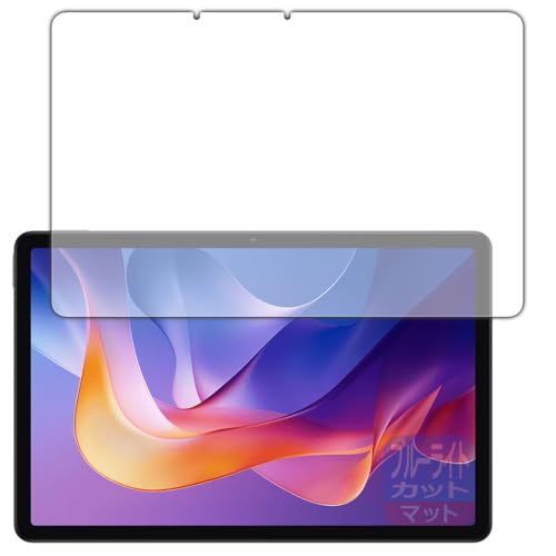 PDA�H�[ Xiaomi Redmi Pad 2 / Redmi Pad 2 4G / Redmi Pad 2 Play Bundle �Ή� �u���[���C�g�J�b�g[���˒ጸ] �ی� �t�B���� ���{��