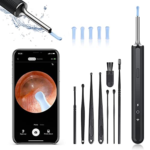 Ear Wax Removal Tool, Ear Cleaner with Camera, Otoscope with Light, Ear Wax Camera with 1080P, Ear Camera for iPhone, iPad, Android Phones