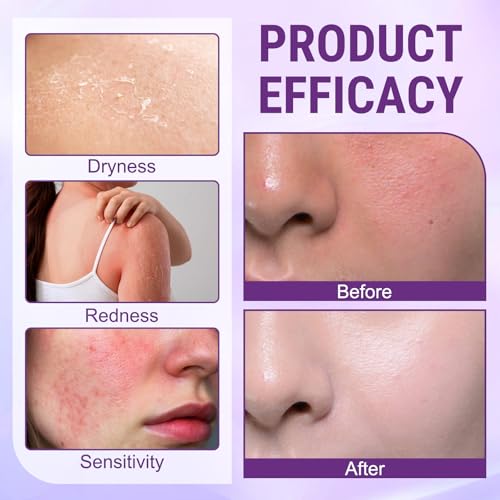 Generic 2pcs Biotin 10-in-1 Skin Restoration Cream,2026 New Professional，Effectively smoothes skin and deeply moisturizes Natural Collagen Lifting Serum for All Skin Types