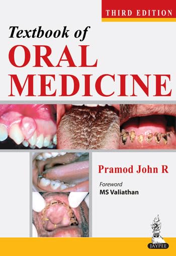 Buy TEXTBOOK OF ORAL MEDICINE Book Online at Low Prices in India ...