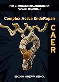 Complex Aorta EndoRepair