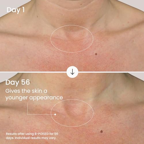 Crème cou et décolleté MAËLYS solution rides horizontales et perte de fermeté