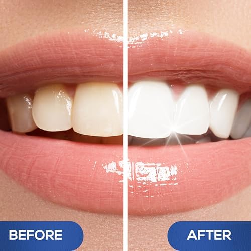 Venus Visage Teeth Whitening Pen and Tooth Polishing Kit (Pack of 4) – Professional Teeth Whitening Gel, 30+ Uses, Low Sensitivity, Enamel-Safe Mint Formula – Removes Coffee, Wine & Tobacco Stains Detail
