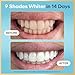 Lumineux Teeth Whitening Strips - 21 Treatments (3 Months) - Peroxide Free - Enamel Safe for Whiter Teeth - Whitening Without The Sensitivity - Dentist Formulated - Sensitivity