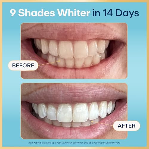 36% Off Lumineux Teeth Whitening Strips - 21 Treatments