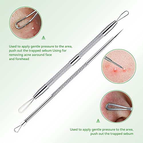ChenYiJin Pimple Popper Tool Kit,Blackhead Remover Tool 5 Pcs Blackhead Extractor Tool for Face Comedone Zit Acne Whitehead Blemish, Stainless Steel Extraction Tools Set