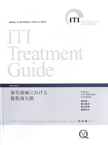 ITI Treatment Guide Volume 6 ※非裁断 ITI Treatment Guide Volume 6 審美領域における複数歯欠損