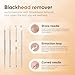 Blackhead Remover Vacuum - Professional Blackhead Extractor for Face with 3 Adjustable Suction Levels, USB Rechargeable Pore Cleaner, and 5 Interchangeable Probes (White)