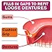 Cushion Grip Thermoplastic Denture Adhesive 1 oz – Refits & Tightens Loose Dentures, Secure Custom Fit, Long-Lasting Comfort, Waterproof, Zinc-Free