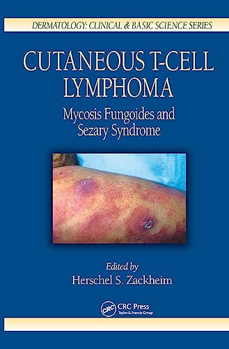 Cutaneous T-Cell Lymphoma: Mycosis Fungoides and Sezary Syndrome (Dermatology: Clinical & Basic Science, 26)