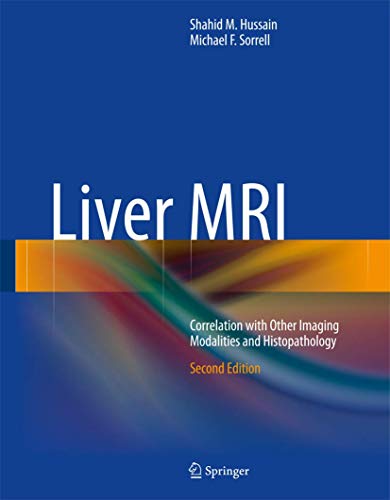 Liver MRI view 2