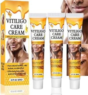 White 3pcs White Fleck Creme, Vitiligo Crema Cuidado de la Piel, Crema de Vitiligo para Manchas Blancas, Crema Repigmentadora Para Manchas Blancas Y Vitiligo