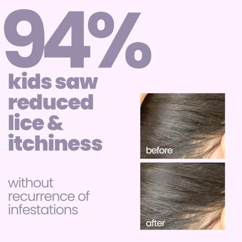 Image of Tuco Kids Natural Lice Buster Shampoo | Infused with Camphor, Neem, Tea Tree Oil | Perfect for Lice & Itchy Scalp | Ages 2-5, 4-10, 10-15, 5-10 Years | Paraben & SLS Free |40ml