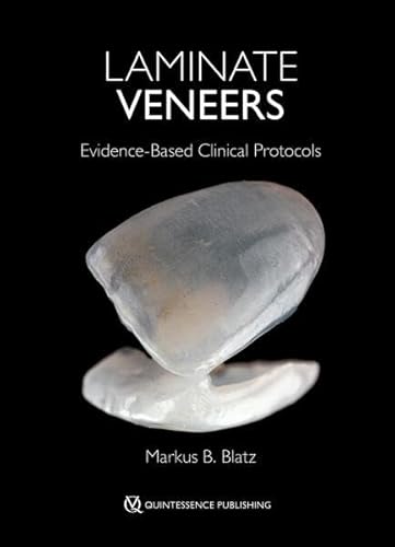 Laminate Veneers: Evidence-Based Clinical Protocols