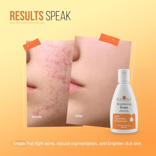 The Element Manjistha Brightening Drops 30 ml - Image 6