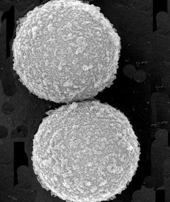 GE Healthcare Life Sciences 65152105050250 Speed Bead Magnetic Carboxylate Modified Particles, 1 um, 5% Solids, 15 mL, 0.05% Sodium Azide, 1095 Days Shelf Life, 2 degree C Lower Temperature