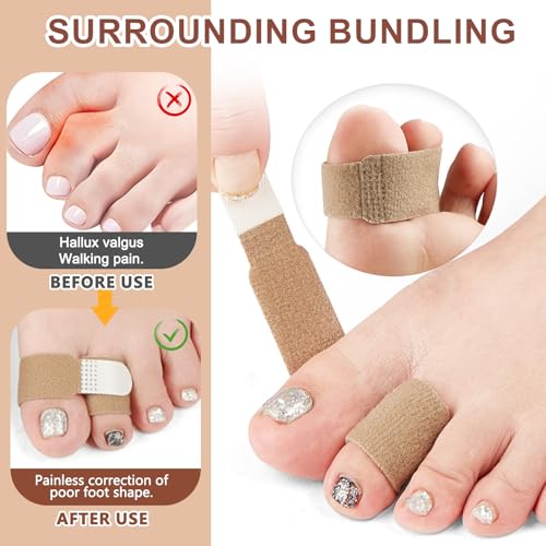 10 Stück Trigger Finger Schiene,Finger Klammer Schiene Fingerbandage für Kleiner Finger, mittelfinger, ringfinger, Bandage Finger, Verstellbare Fingerschutz