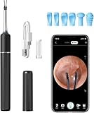 Ohrenschmalz-Entfernungsset, Ohrkamera, 10 MP HD WiFi, kabelloser Ohrenreiniger mit 6 LED-Licht, Ohrenreiniger mit Ohrstöpsel und Pinzette, 3,2 mm visuelles Ohr-Otoskop-Endoskop, Schwarz