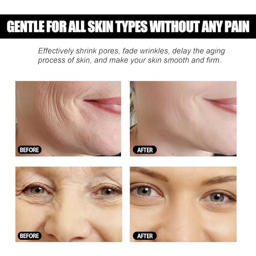 Grgowe Turmeric Face 2Pc Instant Face Lift Cream,Cream Instantané Pour Le Visage,Crème Lifting Instantané,Cream Anti-Rides Pour Le Visage,Smooth & Lift Loose Sagging For All Skin – vue 4
