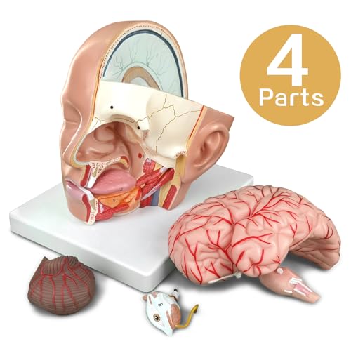 Modèle d'artère cervicale AMITD de haute précision pour écoles médicales - 6