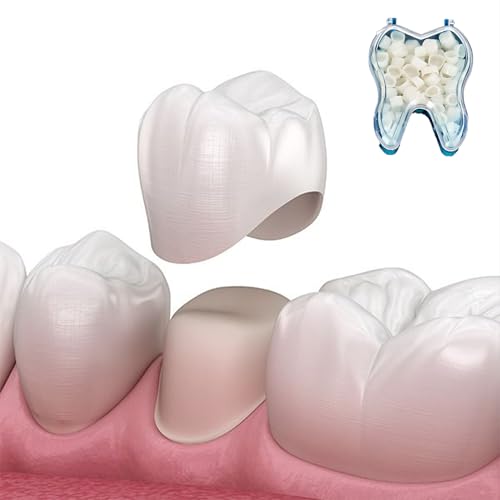 Image of Temporary Tooth Veneer Crowns Kit - 100PCS /Box (50 Anterior + 50 Posterior) - DIY Fake Teeth Cap for Missing Teeth & Natural-Looking Smile Restoration for Holiday Cosplay