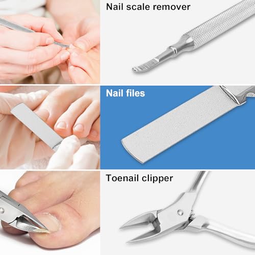 EEEKit Kit de remoção de unhas encravadas, conjunto de facas de pedicure, conjunto de cortador de un