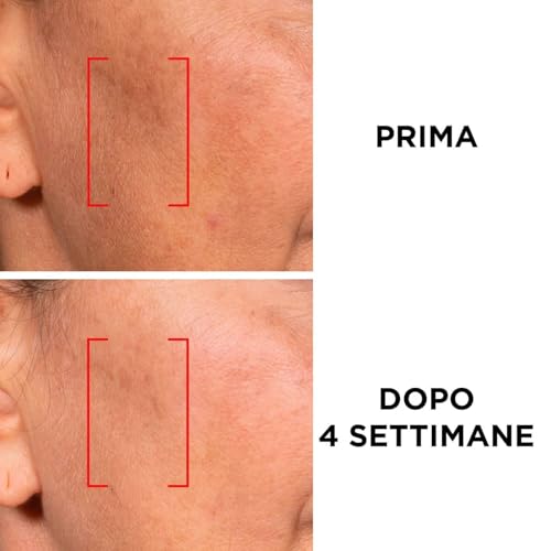 Crema Revitalift Laser L'Oreal combate arrugas y manchas con retinol y filtro SPF 20 2