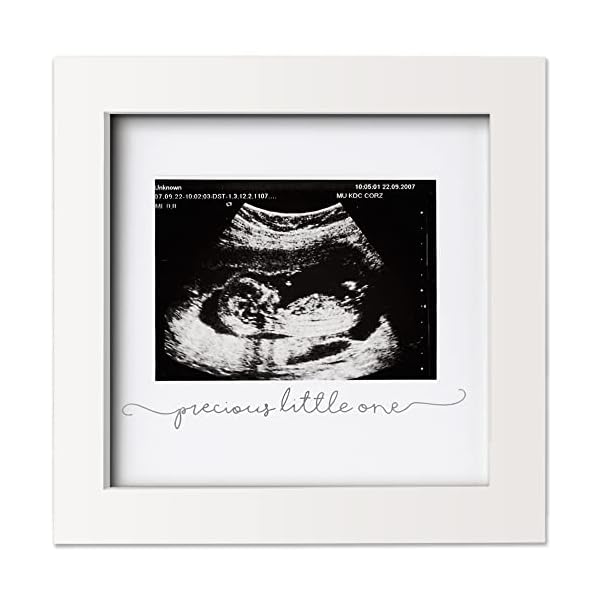Marco De Fotos Para Ecografía De Bebé - Marco De Ultrasonido Moderno Para La Futura Mamá - Marco De Ecografía Para…