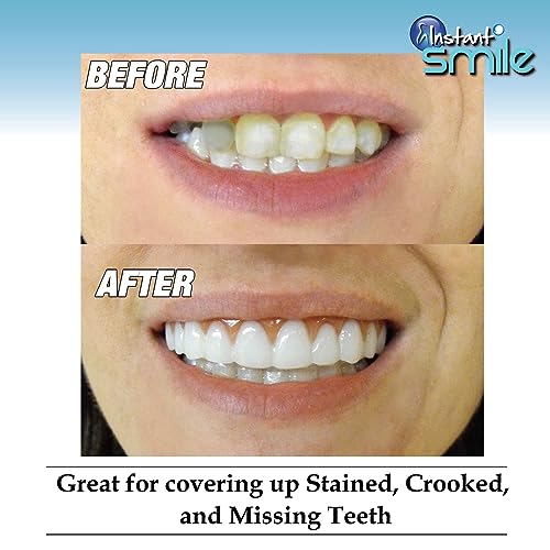 Instant Smile 12205 Comfort Fit Flex - Bright Shade - Upper Veneer Cosmetic Teeth thumb #2