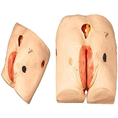 Modèle de soins des escarres avec évaluation multi-stades pour cours de soins infirmiers