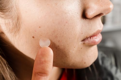 Calcomanías para cara TOPMED parches acné 48 unidades 7