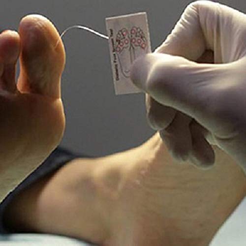 semmes weinstein monofilament wire 507 10g neuropathy diabetic testing kits 20 disposable filaments