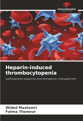 Heparin-induced thrombocytopenia: pathogenesis diagnosis and therapeutic management