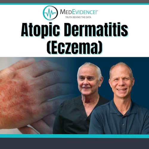 A Timely Discussion About Atopic Dermatitis (Eczema)