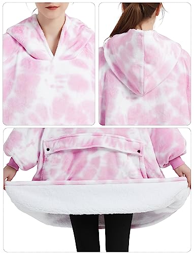 Image of KFUBUO Wearable Blanket Hoodie for Adults Sherpa All Patterns Oversized Sweatshirt Blanket with Pocket