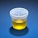Globe Scientific 5917 Polypropylene Graduated Specimen Container with Polyethylene Separate Snap Cap, 5 oz Capacity (Case of 300)