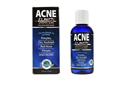 Acne Slayer-4.6 oz Bottle-Ultimate Treatment for Acne, Rosacea, Pimples, Zits, Blackheads, Bacne, Breakouts and More!