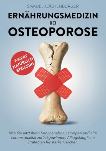 Ernährungsmedizin bei Osteoporose: Von gesunder zu knochenstarker Ernährung: Machen Sie die Ernährung zu Ihrer stärksten Waffe gegen Osteoporose. ... ganzheitlich verstehen & behandeln)