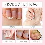 Cuticle Oil for Nails - Coconut Nail Oil,Cuticle Remover,N/ail Strengthener for Damaged Nail/s,Nai/l Growth Treatment,Na/il Cuticle Remover,Cuticle Oil Pen for Na/ils,N/ail Growth Serum,N/ail Oil,5ml - Image 6