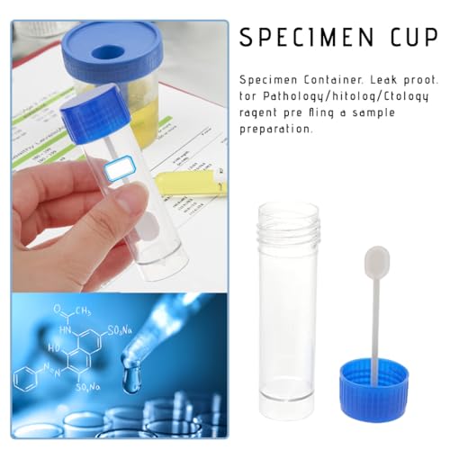 FENQURO 20 Stück 20ml Stuhlprobenröhrchen mit Etikettenaufkleber, urinbecher, Kotprobenröhrchen mit Löffel, Probenröhrchen für Haustiere zum Testen, Stuhlröhrchen mit Deckel Gute Abdichtung