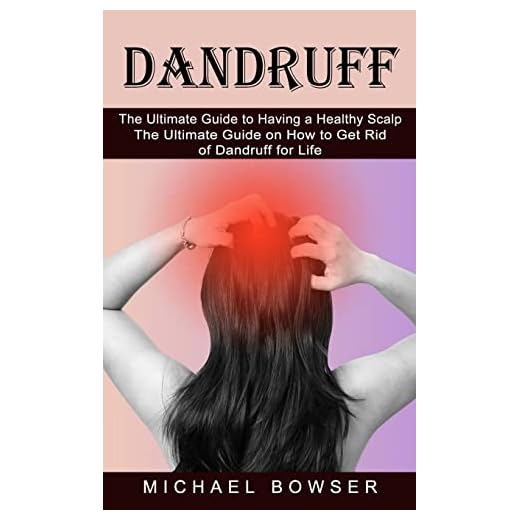 Dandruff: The Ultimate Guide to Having a Healthy Scalp (The Ultimate Guide on How to Get Rid of Dandruff for Life)